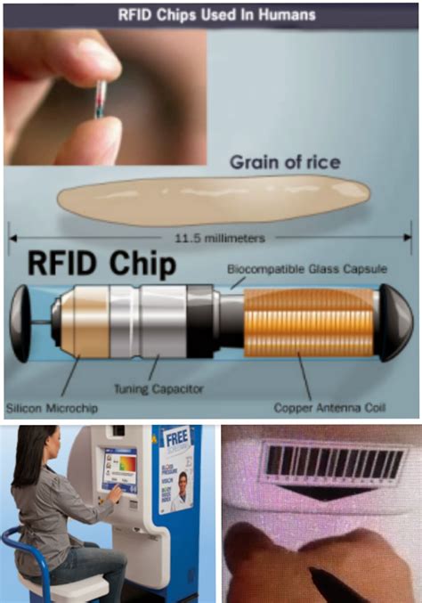 countries with rfid chips|rfid chip implants.